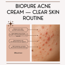 Biopure Anti Acne Cream
